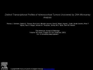 Distinct Transcriptional Profiles of Adrenocortical Tumors Uncovered by