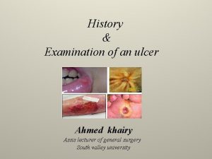 History Examination of an ulcer Ahmed khairy Assis