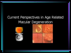 Current Perspectives in Age Related Macular Degeneration Terminology