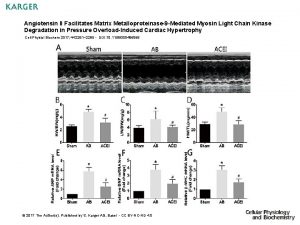 Angiotensin II Facilitates Matrix Metalloproteinase9 Mediated Myosin Light
