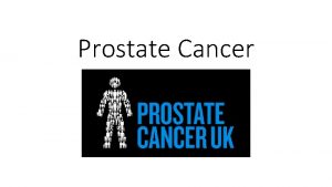 Prostate Cancer Basic facts The prostate is a