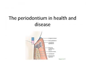 The periodontium in health and disease Pathogenesis Is