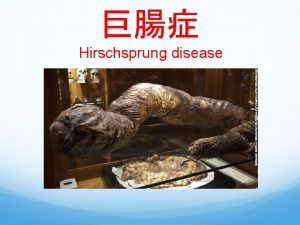 Hirschsprung disease In 1886 Harald Hirschsprung Queen Louise