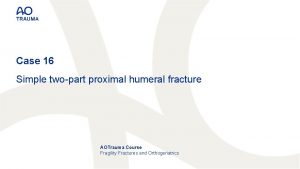 Case 16 Simple twopart proximal humeral fracture AOTrauma