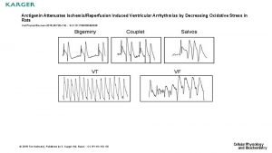 Arctigenin Attenuates IschemiaReperfusion Induced Ventricular Arrhythmias by Decreasing