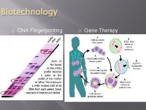 Biotechnology DNA Fingerprinting Gene Therapy Genetic Engineering Genetically