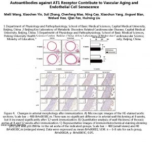 Autoantibodies against AT 1 Receptor Contribute to Vascular