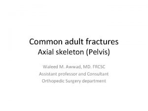 Common adult fractures Axial skeleton Pelvis Waleed M