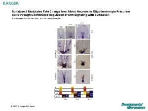 Sulfatase 2 Modulates Fate Change from Motor Neurons