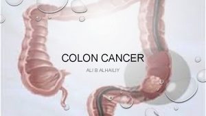 COLON CANCER ALI B ALHAILIY COLORECTAL CANCER COLORECTAL