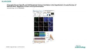 Kisspeptin NeuronSpecific and SelfSustained Calcium Oscillation in the