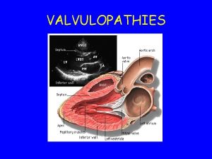 VALVULOPATHIES Rappel physiologique VALVULOPATHIES Dfinition maladie des valves
