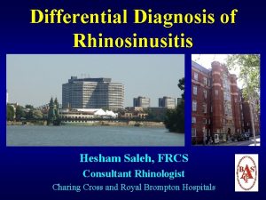 Differential Diagnosis of Rhinosinusitis Hesham Saleh FRCS Consultant