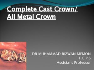 Complete Cast Crown All Metal Crown DR MUHAMMAD