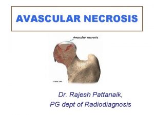 AVASCULAR NECROSIS Dr Rajesh Pattanaik PG dept of