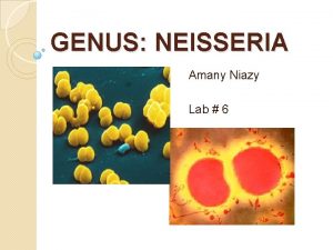 GENUS NEISSERIA Amany Niazy Lab 6 NEISSERIA SPECIES