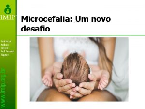 Microcefalia Um novo desafio Gestante com rash cutneo