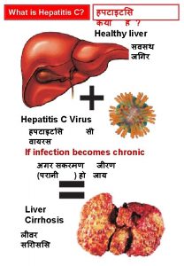 What will happen in Liver Cirrhosis Healthy liver