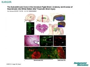 The Subventricular Zone in the Immature Piglet Brain