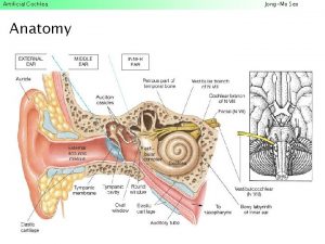 Artificial Cochlea Anatomy JongMo Seo Artificial Cochlea How