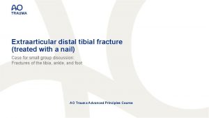 Extraarticular distal tibial fracture treated with a nail