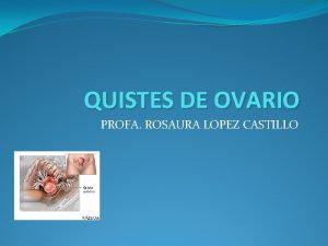 QUISTES DE OVARIO PROFA ROSAURA LOPEZ CASTILLO Origen