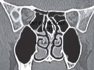 ENT PATHOLOGY LECT 3 ALI B ALHAILIY ENT