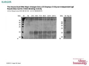 The House Dust Mite Major Allergen Der p