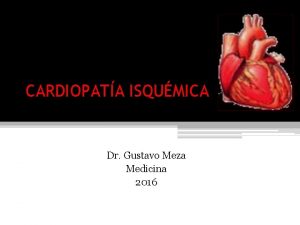 CARDIOPATA ISQUMICA Dr Gustavo Meza Medicina 2016 CARDIOPATAS