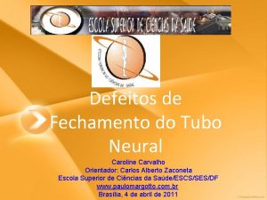 Defeitos de Fechamento do Tubo Neural Caroline Carvalho