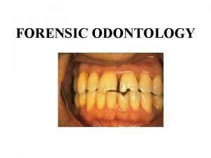FORENSIC ODONTOLOGY History 66 A D Nero the