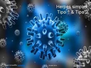 Herpes simplex Tipo 1 Tipo 2 BIO 348