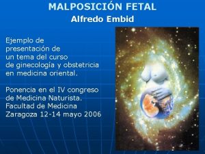 MALPOSICIN FETAL Alfredo Embid Ejemplo de presentacin de