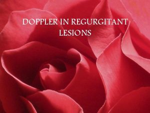 DOPPLER IN REGURGITANT LESIONS Regurg Lesions Doppler Indirect
