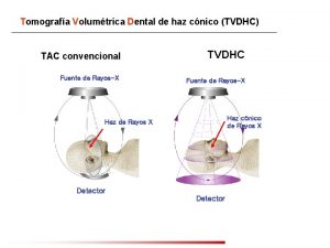 Tomografa Volumtrica Dental de haz cnico TVDHC TAC