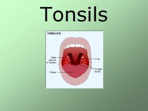 Tonsils Tonsils are large lymphoid tissue situated in