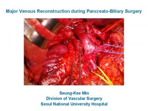 Major Venous Reconstruction during PancreatoBiliary Surgery SeungKee Min