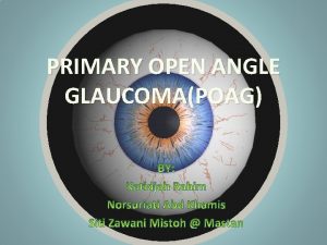 PRIMARY OPEN ANGLE GLAUCOMAPOAG DEFINITION Primary openangle glaucoma