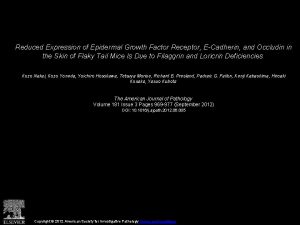 Reduced Expression of Epidermal Growth Factor Receptor ECadherin