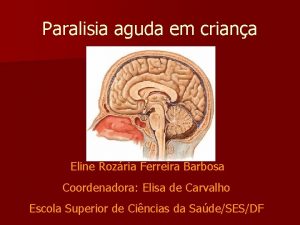 Paralisia aguda em criana Eline Rozria Ferreira Barbosa