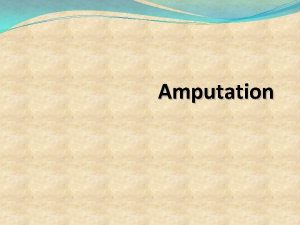 Amputation Definition It is the removal of a