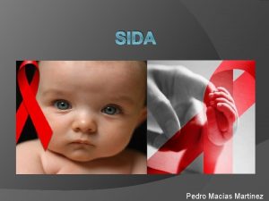 SIDA Pedro Macas Martnez Etiologa Epidemiologia La Organizacin