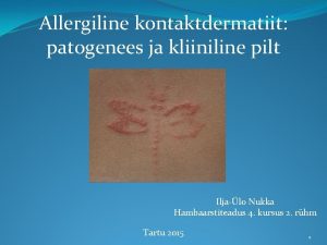 Allergiline kontaktdermatiit patogenees ja kliiniline pilt Iljalo Nukka