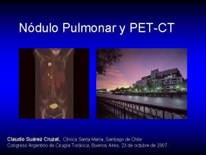 Ndulo Pulmonar y PETCT Claudio Surez Cruzat Clnica