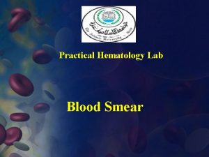 Practical Hematology Lab Blood Smear I Preparation Of