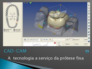 CADCAM A tecnologia a servio da prtese fixa