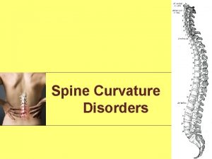 Spine Curvature Disorders Types of Spine Curvature Disorders