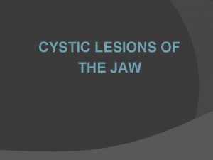 CYSTIC LESIONS OF THE JAW Anatomy of mandible