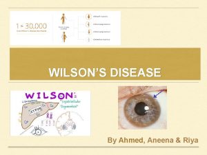 WILSONS DISEASE By Ahmed Aneena Riya BACKGROUND Wilsons