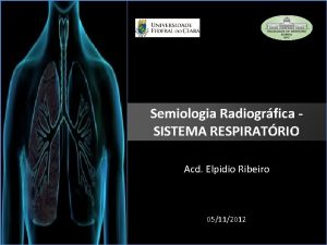 Semiologia Radiogrfica SISTEMA RESPIRATRIO Acd Elpidio Ribeiro 05112012